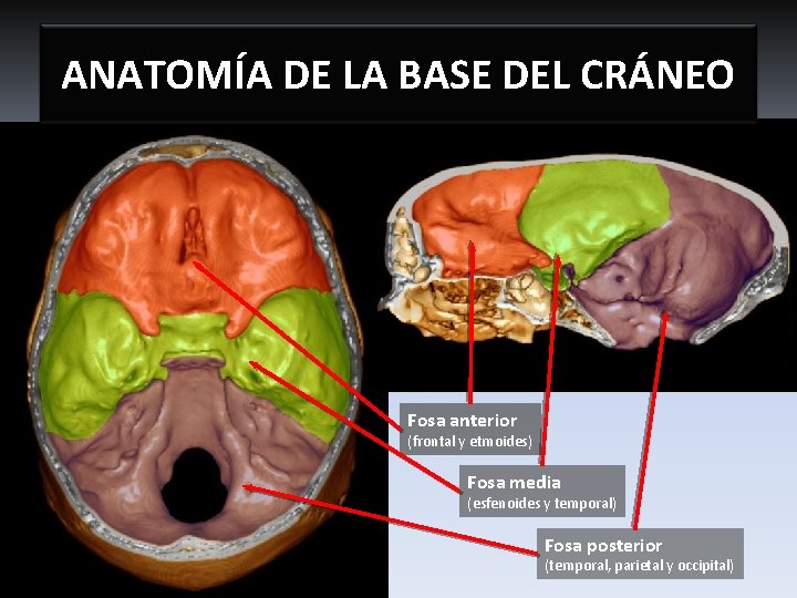 ANATOMÍA DE LA BASE DEL CRÁNEO Fosa anterior (frontal y etmoides) Fosa media (esfenoides