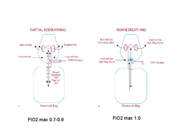 Fi. O 2 max 0. 7 -0. 8 Fi. O 2 max 1. 0