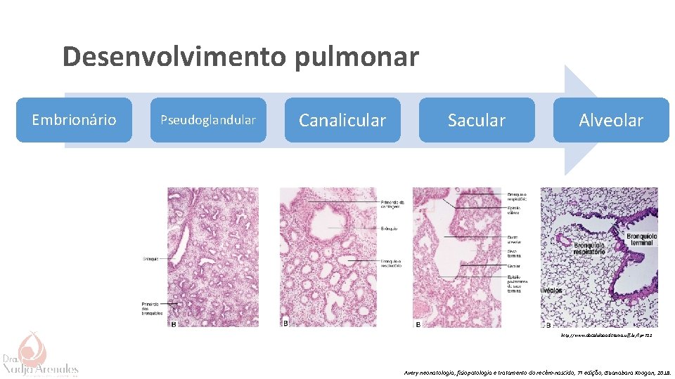 Desenvolvimento pulmonar Embrionário Pseudoglandular Canalicular Sacular Alveolar http: //www. dacelulaaosistema. uff. br/? p=712 Avery