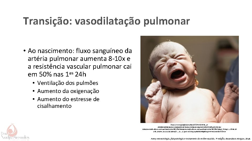 Transição: vasodilatação pulmonar • Ao nascimento: fluxo sanguíneo da artéria pulmonar aumenta 8 -10