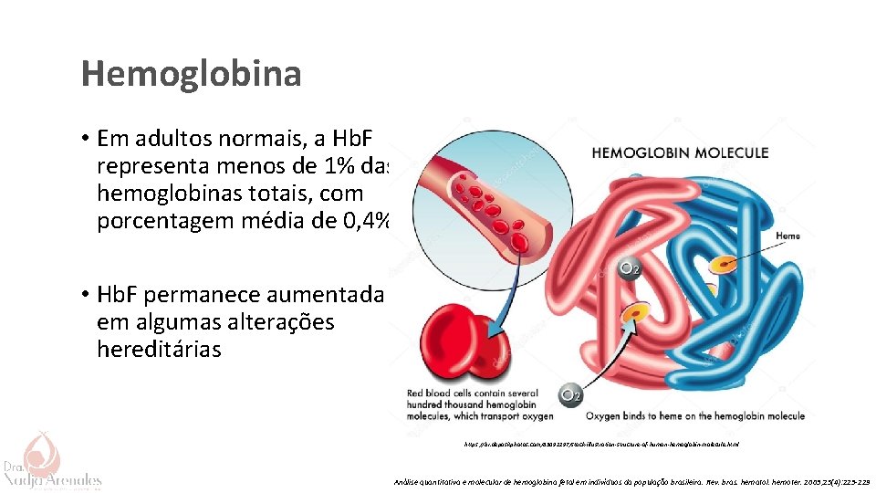 Hemoglobina • Em adultos normais, a Hb. F representa menos de 1% das hemoglobinas