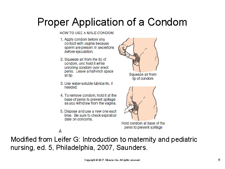 Proper Application of a Condom Modified from Leifer G: Introduction to maternity and pediatric