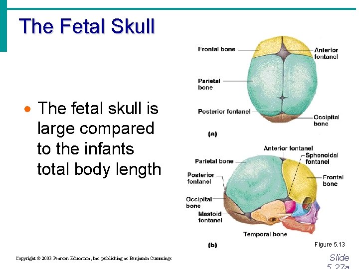 The Fetal Skull · The fetal skull is large compared to the infants total