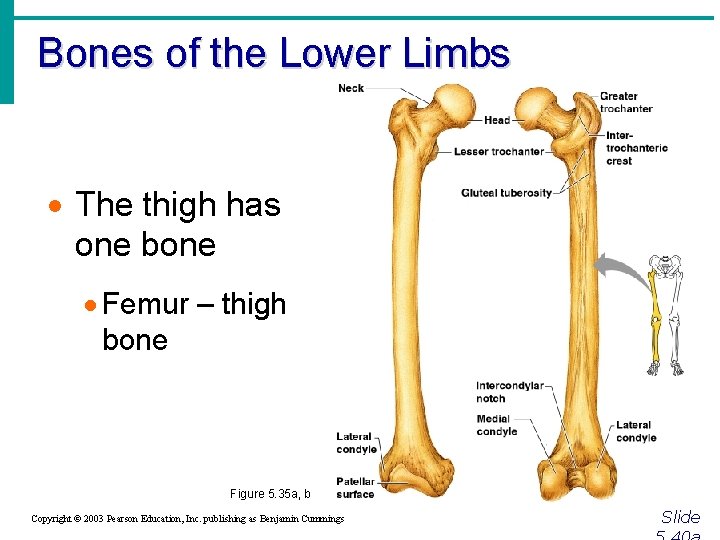 Bones of the Lower Limbs · The thigh has one bone · Femur –