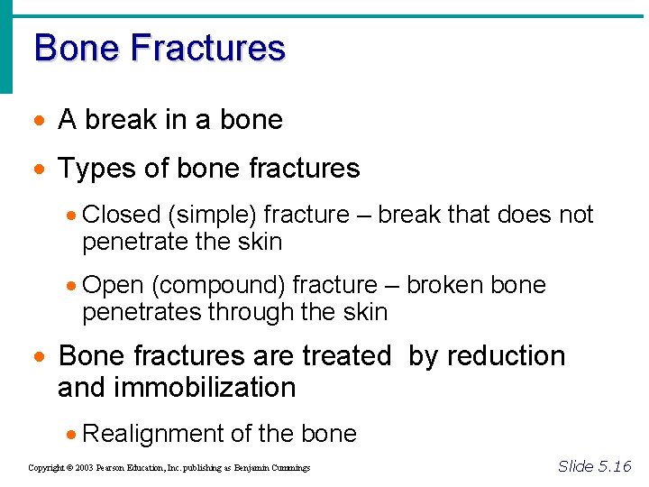 Bone Fractures · A break in a bone · Types of bone fractures ·