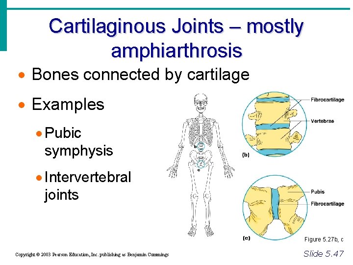 Cartilaginous Joints – mostly amphiarthrosis · Bones connected by cartilage · Examples · Pubic