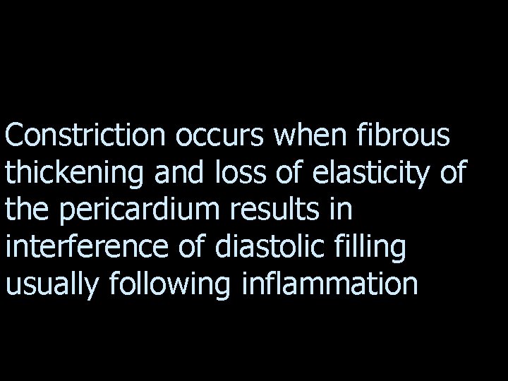 Constriction occurs when fibrous thickening and loss of elasticity of the pericardium results in