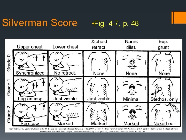 Silverman Score • Fig. 4 -7, p. 48 