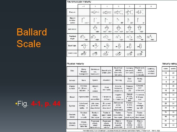 Ballard Scale • Fig. 4 -1, p. 44 