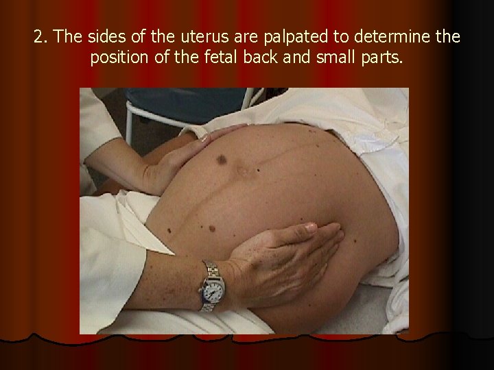 2. The sides of the uterus are palpated to determine the position of the