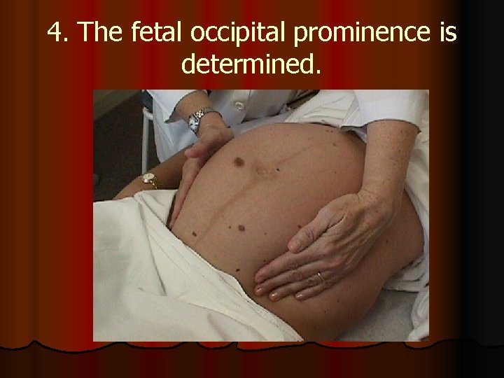 4. The fetal occipital prominence is determined. 