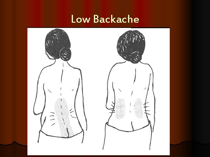 Low Backache 