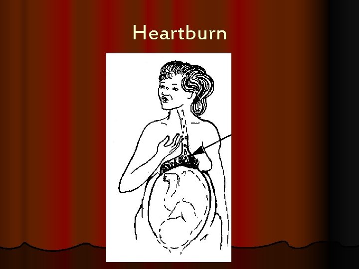 Heartburn 