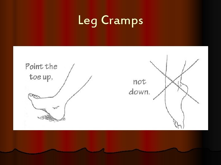 Leg Cramps 