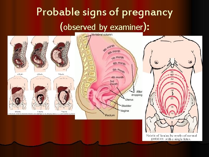 Probable signs of pregnancy (observed by examiner): 