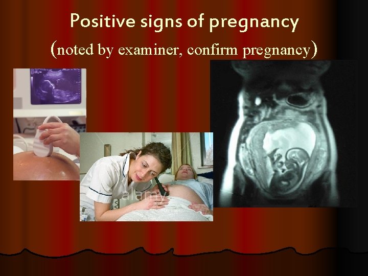 Positive signs of pregnancy (noted by examiner, confirm pregnancy) 