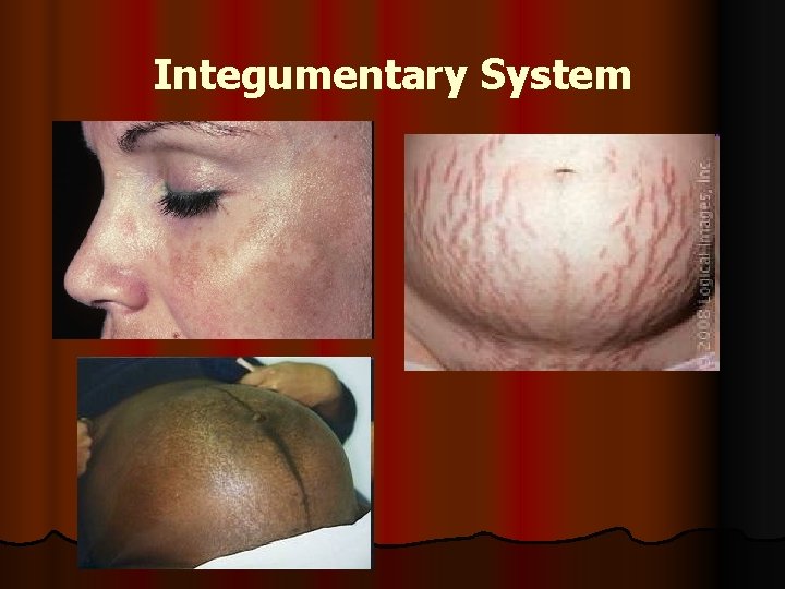 Integumentary System 