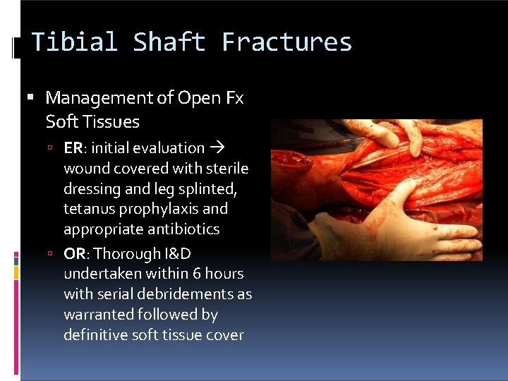 Tibial Shaft Fractures Management of Open Fx Soft Tissues ER: initial evaluation wound covered