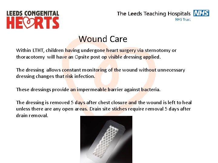 Wound Care Within LTHT, children having undergone heart surgery via sternotomy or thoracotomy will