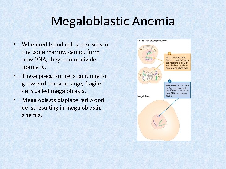 Megaloblastic Anemia • When red blood cell precursors in the bone marrow cannot form
