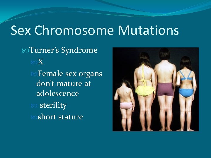 Sex Chromosome Mutations Turner’s Syndrome X Female sex organs don't mature at adolescence sterility