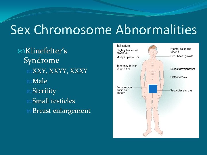 Sex Chromosome Abnormalities Klinefelter’s Syndrome XXY, XXYY, XXXY Male Sterility Small testicles Breast enlargement