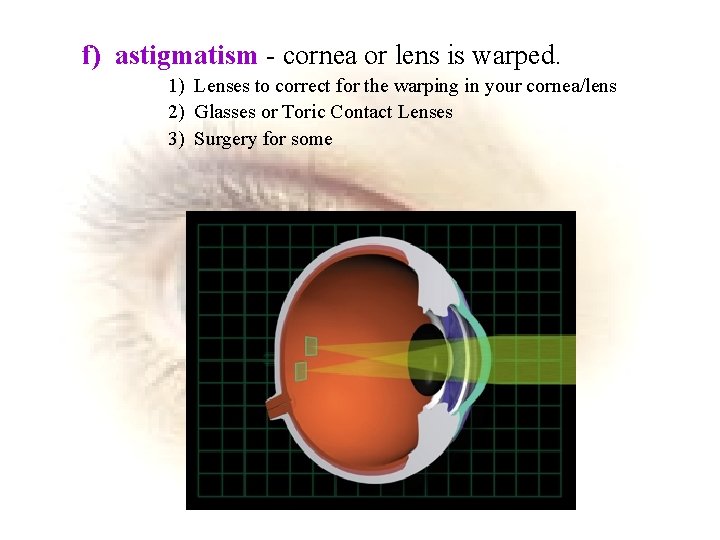 f) astigmatism - cornea or lens is warped. 1) Lenses to correct for the
