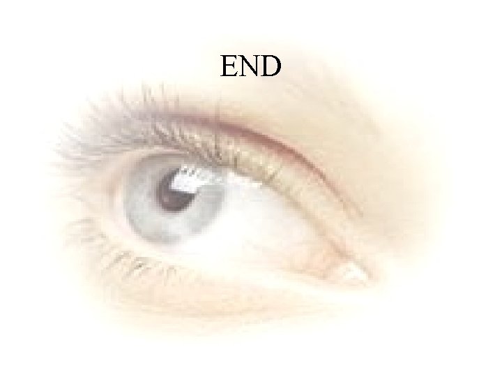 END 
