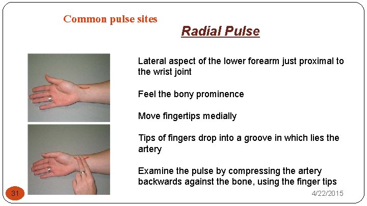 Common pulse sites Radial Pulse Lateral aspect of the lower forearm just proximal to