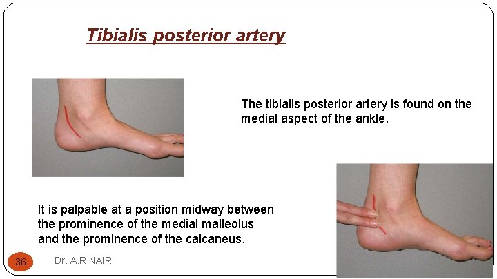 Tibialis posterior artery The tibialis posterior artery is found on the medial aspect of