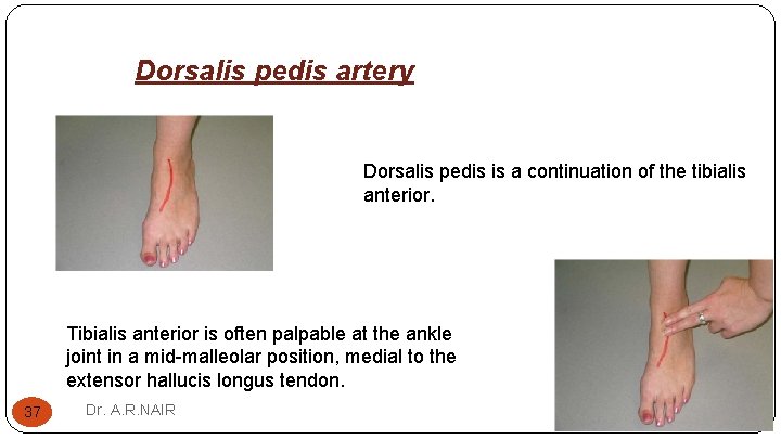 Dorsalis pedis artery Dorsalis pedis is a continuation of the tibialis anterior. Tibialis anterior