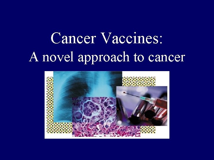 Cancer Vaccines: A novel approach to cancer 