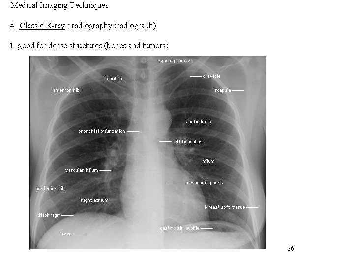 Medical Imaging Techniques A. Classic X-ray : radiography (radiograph) 1. good for dense structures