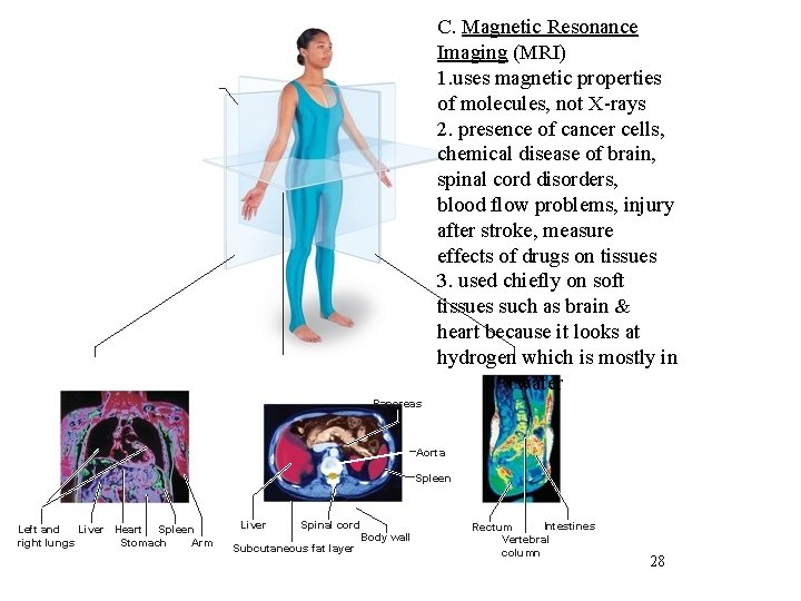 C. Magnetic Resonance Imaging (MRI) 1. uses magnetic properties of molecules, not X-rays 2.