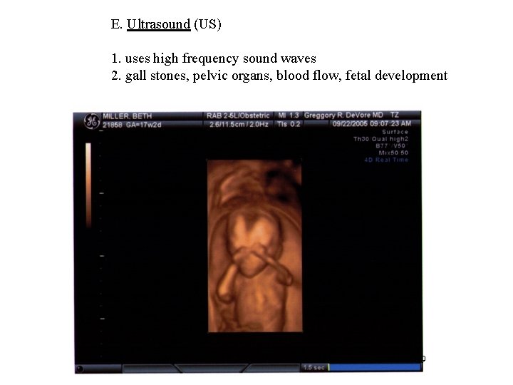 E. Ultrasound (US) 1. uses high frequency sound waves 2. gall stones, pelvic organs,