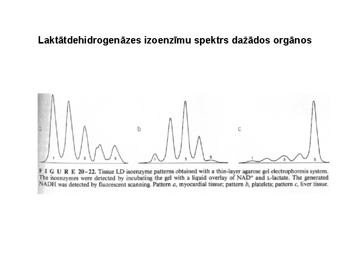 Laktātdehidrogenāzes izoenzīmu spektrs dažādos orgānos Laktātdehidrogenāzes izoenzīmu spektrs dažādos orgānos