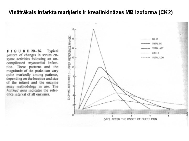 Visātrākais infarkta marķieris ir kreatīnkināzes MB izoforma (CK 2) Visātrākais infarkta marķieris ir kreatīnkināzes MB izoforma (CK 2)