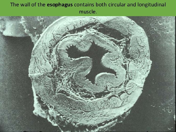 The wall of the esophagus contains both circular and longitudinal muscle. 