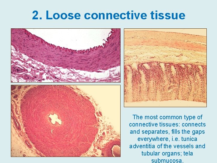 2. Loose connective tissue The most common type of connective tissues: connects and separates,