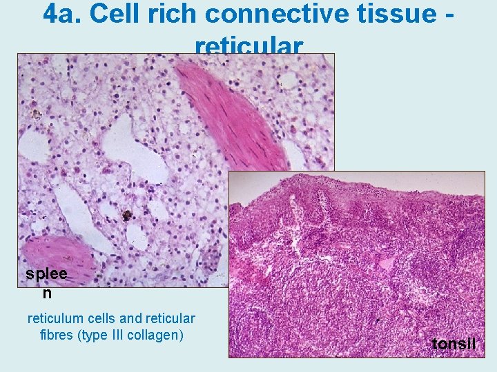 4 a. Cell rich connective tissue reticular splee n reticulum cells and reticular fibres