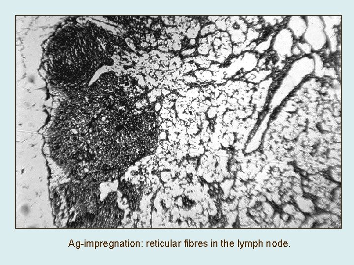 Ag-impregnation: reticular fibres in the lymph node. 