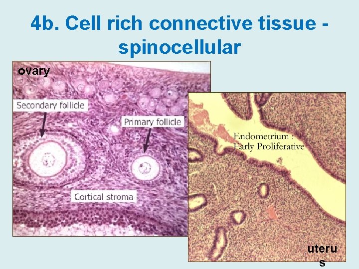 4 b. Cell rich connective tissue spinocellular ovary uteru s 