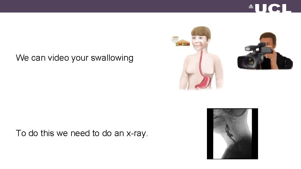 We can video your swallowing To do this we need to do an x-ray.