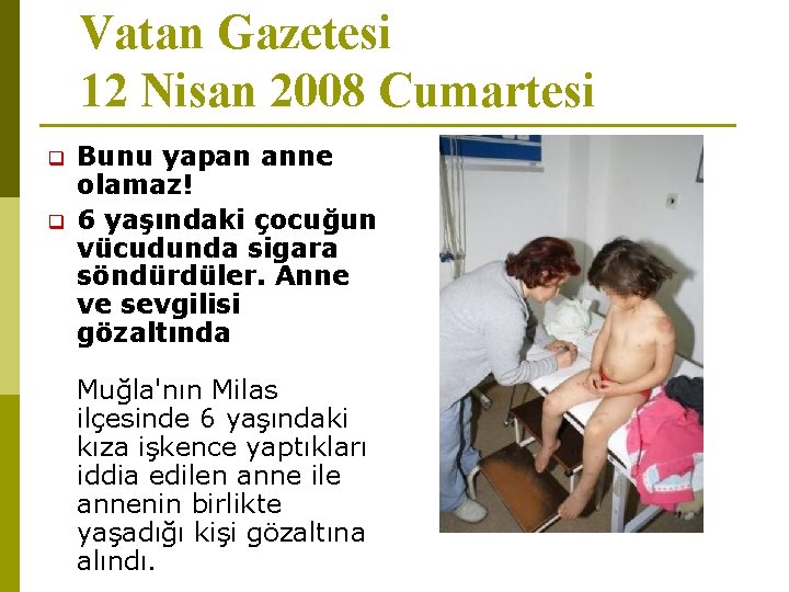 Vatan Gazetesi 12 Nisan 2008 Cumartesi Bunu yapan anne olamaz! 6 yaşındaki çocuğun vücudunda