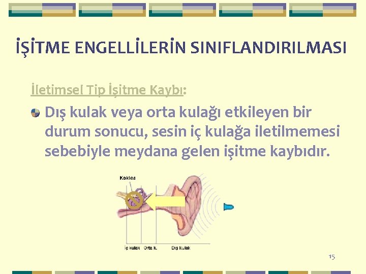 İŞİTME ENGELLİLERİN SINIFLANDIRILMASI İletimsel Tip İşitme Kaybı: Dış kulak veya orta kulağı etkileyen bir