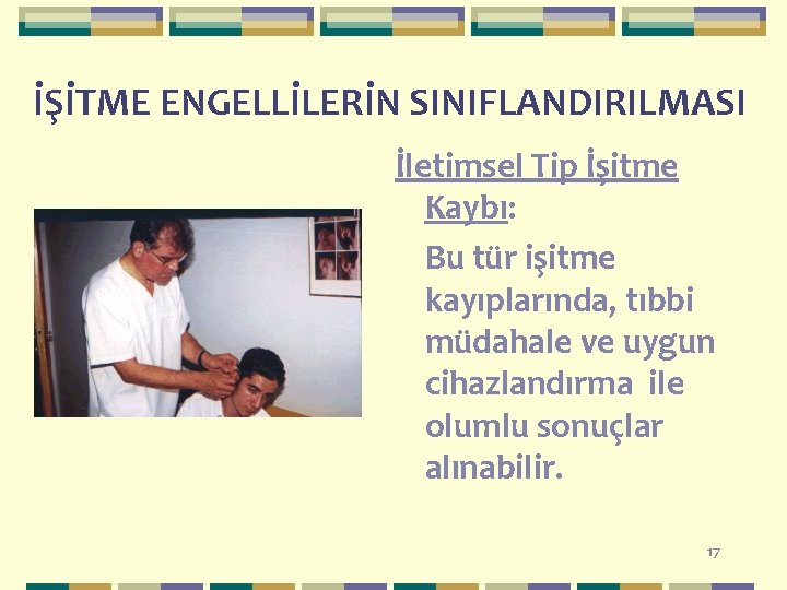 İŞİTME ENGELLİLERİN SINIFLANDIRILMASI İletimsel Tip İşitme Kaybı: Bu tür işitme kayıplarında, tıbbi müdahale ve