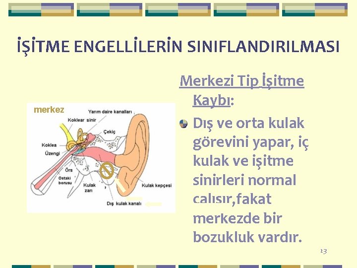 İŞİTME ENGELLİLERİN SINIFLANDIRILMASI merkez Merkezi Tip İşitme Kaybı: Dış ve orta kulak görevini yapar,