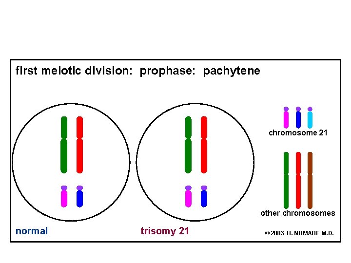 first meiotic division: prophase: pachytene chromosome 21 other chromosomes normal trisomy 21 © 2003