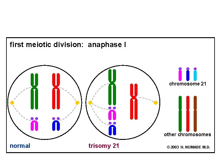 first meiotic division: anaphase I chromosome 21 other chromosomes normal trisomy 21 © 2003