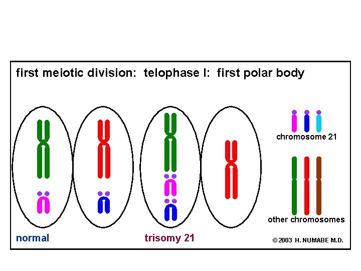 first meiotic division: telophase I: first polar body chromosome 21 other chromosomes normal trisomy